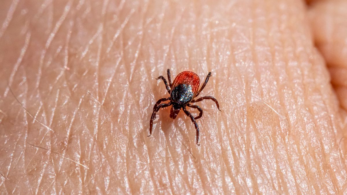 Klíště obecné lezoucí po lidské kůži